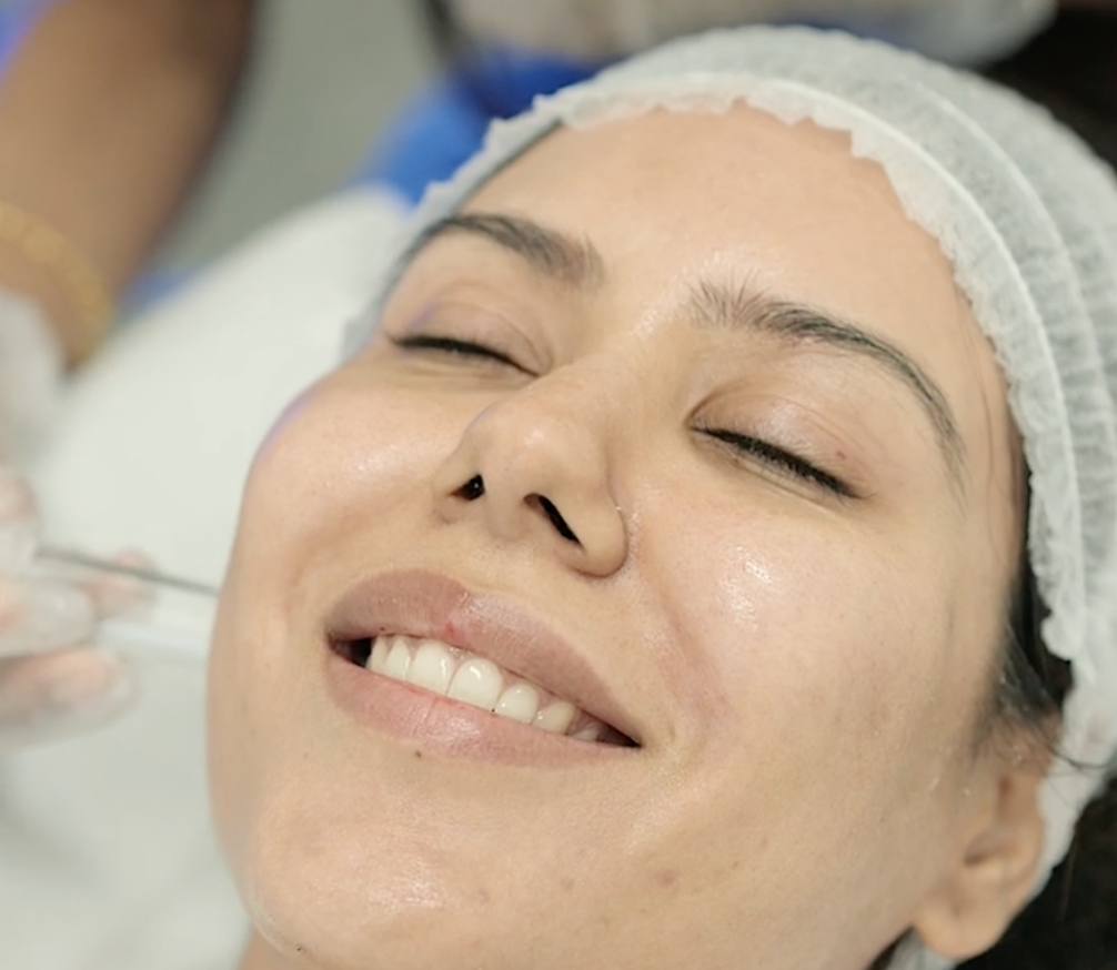 sonam-bajwa-reveals-her-beautiful-skin-secret-este